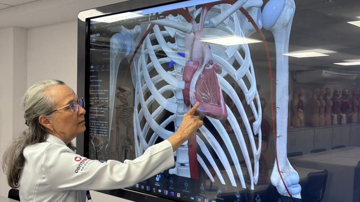 Ilustração médica de um cérebro humano, relacionada ao acidente vascular cerebral